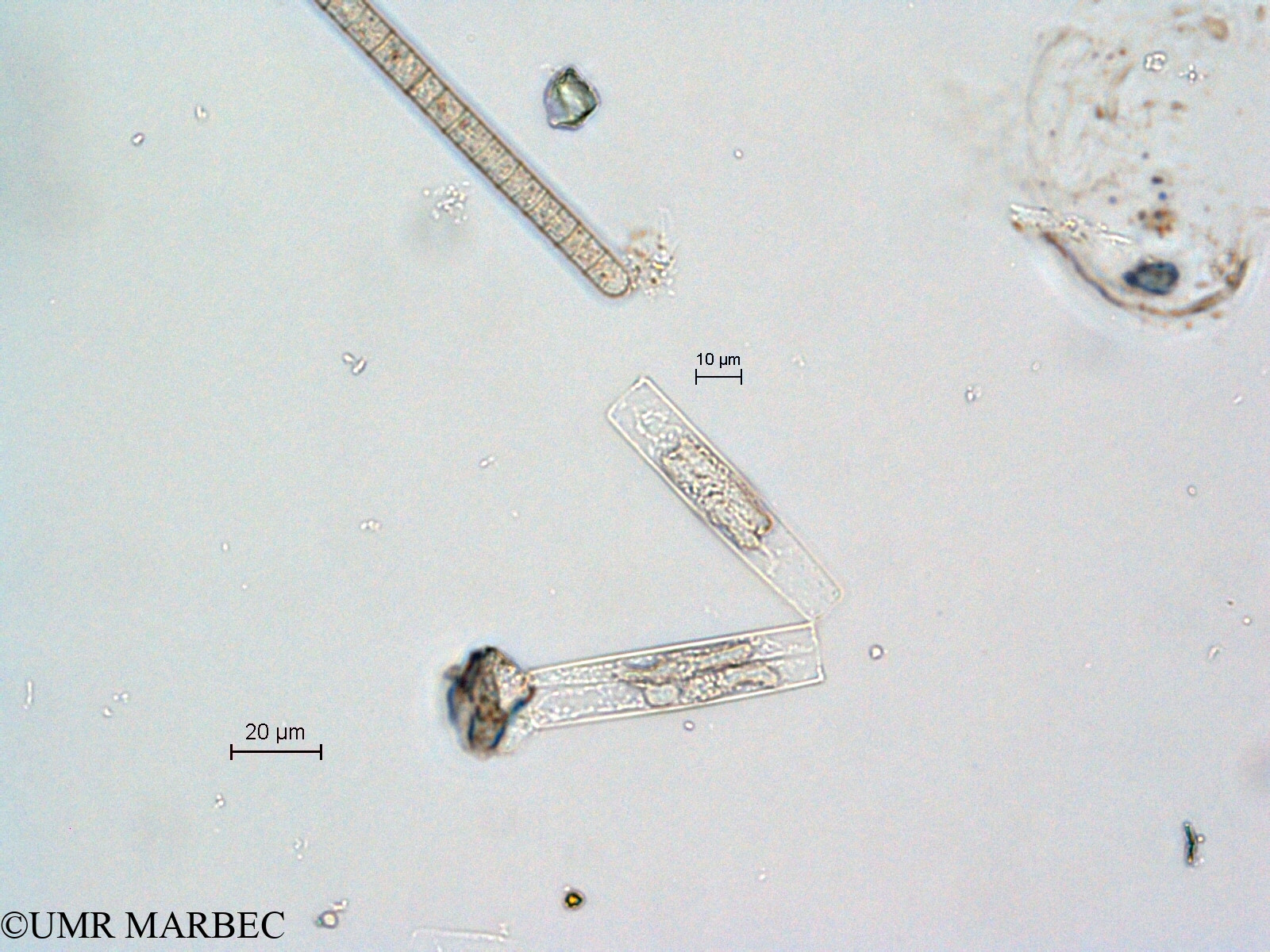 phyto/Scattered_Islands/all/COMMA April 2011/Thalassionema sp2 (recomposé)(copy).jpg